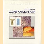 An Atlas of Contraception door Pramilla Senanayake e.a.