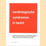 Cardiologische syndromen in beeld door P.G. en anderen Hugenholtz