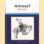 Artrose? Wat nu? 27 verhalen van patiënten door J.W.J. Bijlsma e.a.