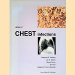 Atlas of Chest Infections door Margaret E. - and others Hodson